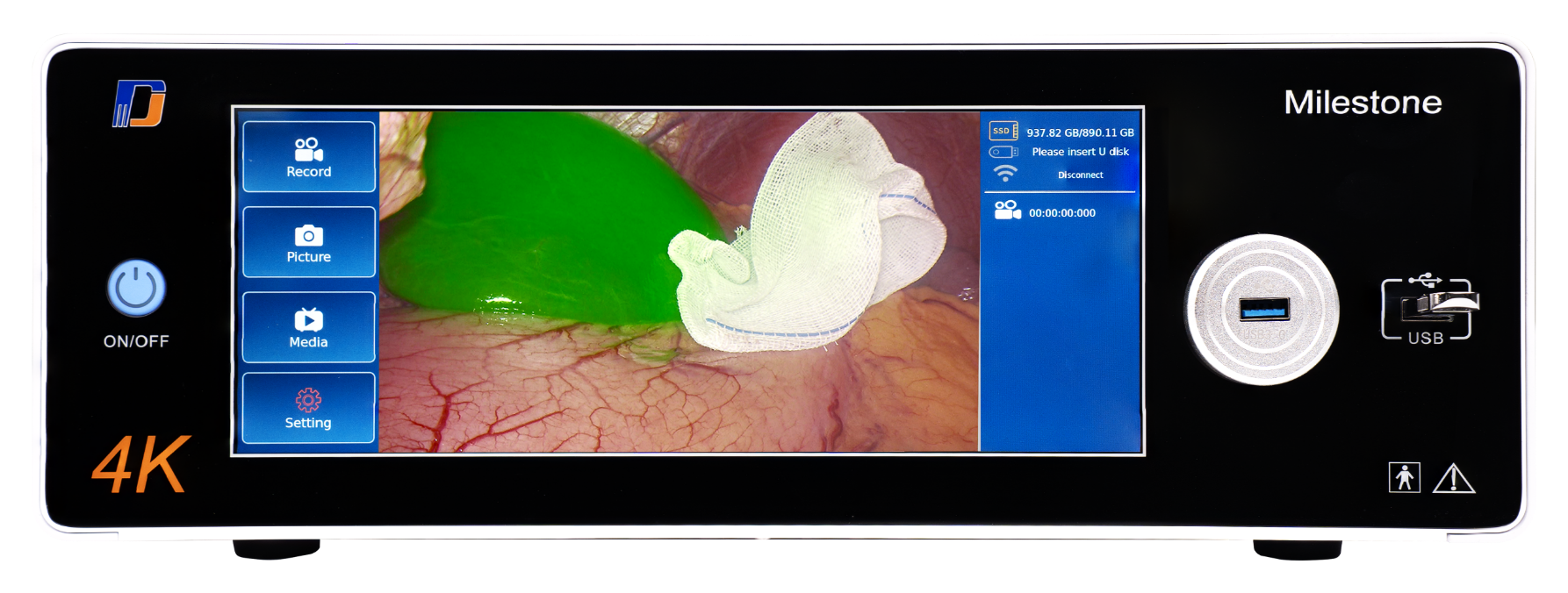 SOINVISION 里程碑 image processing platform