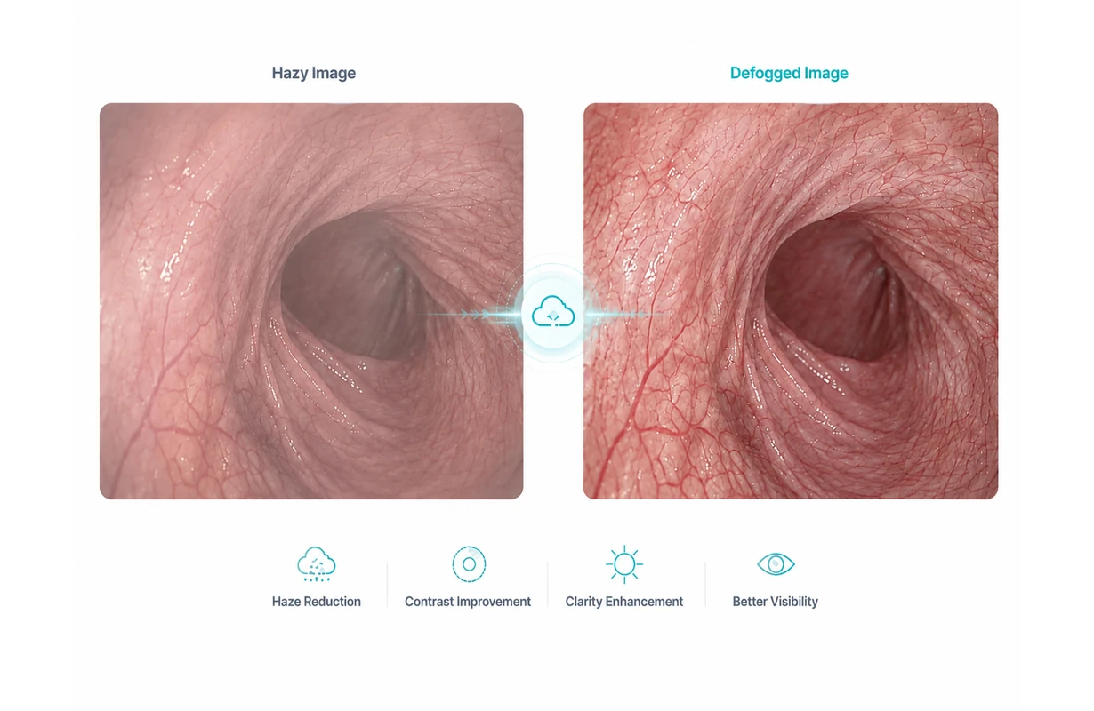 S-VIXTA 去雾 comparison for hazy medical images