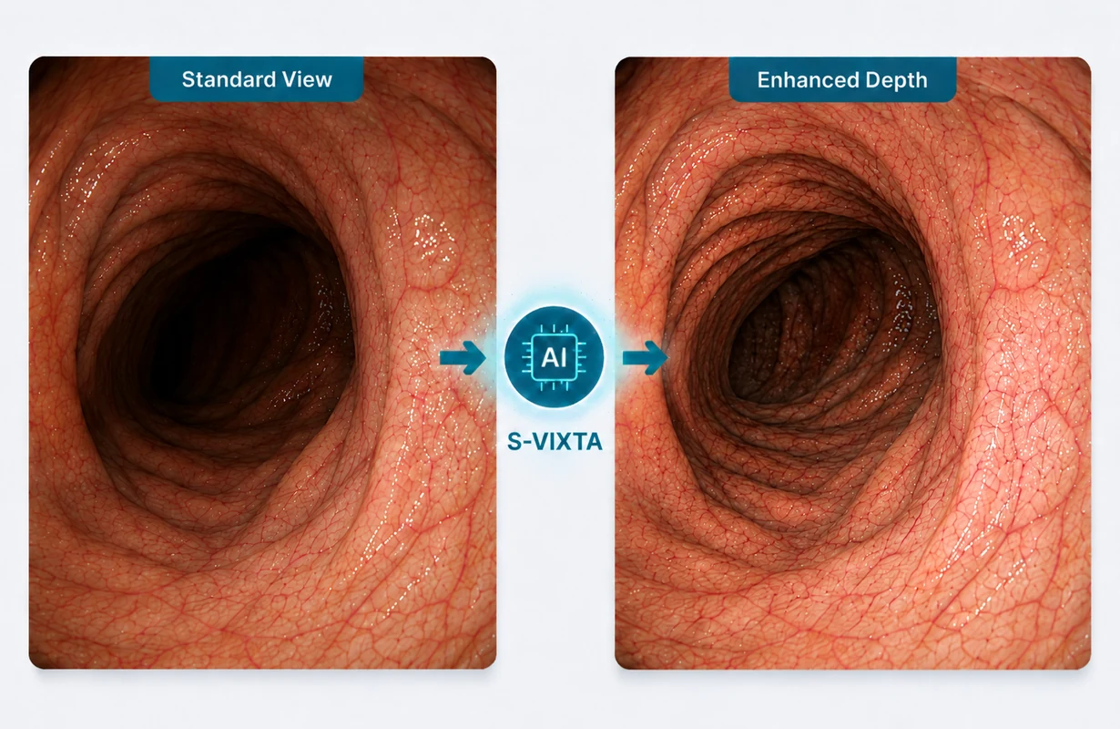 Core visualization comparing standard image presentation with S-VIXTA 景深增强