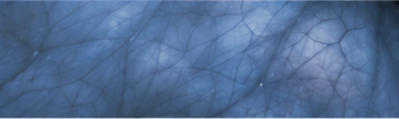 最低 enhancement image presentation