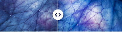 最高 enhancement image presentation